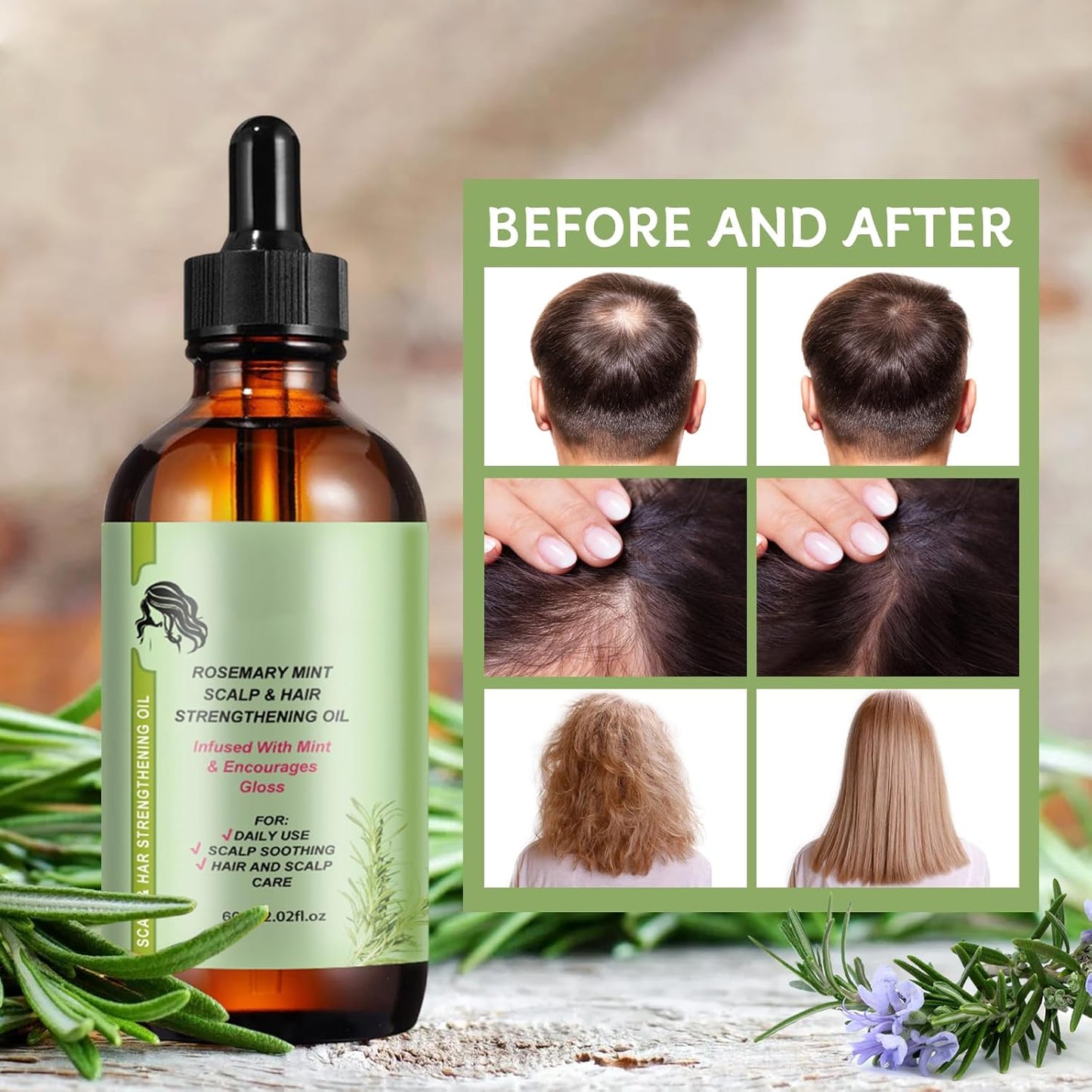 2 Pièces Huile de Romarin Naturelle pour Cheveux